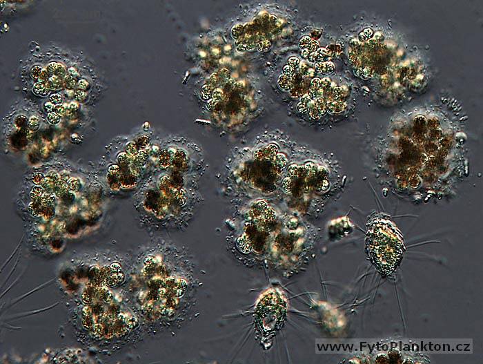 Microcystis viridis & Mallomonas caudata