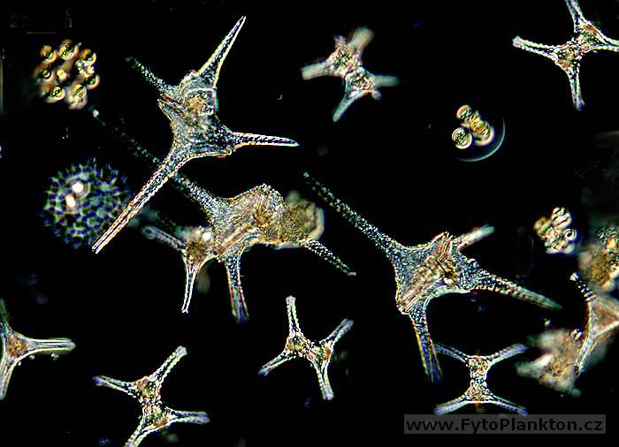 Ceratium hirundinella & Staurastrum planctonicum