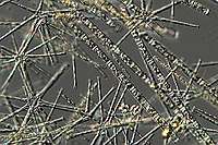 Asterionella formosa & Aulacoseira granulata