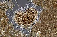 Microcystis aeruginosa, Microcystis ichtyoblabe & Pseudanabaena mucicola