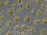 Název:		Staurastrum furcigerum	
Zvětšeno:	200 x
Technika:	Nomarského kontrast
Datum:		2003-07-01
Lokalita: 	Žlutice
