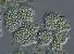 Název:		Microcystis viridis	
Zvětšeno:	400 x
Technika:	Nomarského kontrast
Datum:		2004-07-01
Lokalita: 	Hracholusky u Plzně
